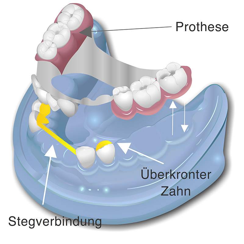 Stegverbindung